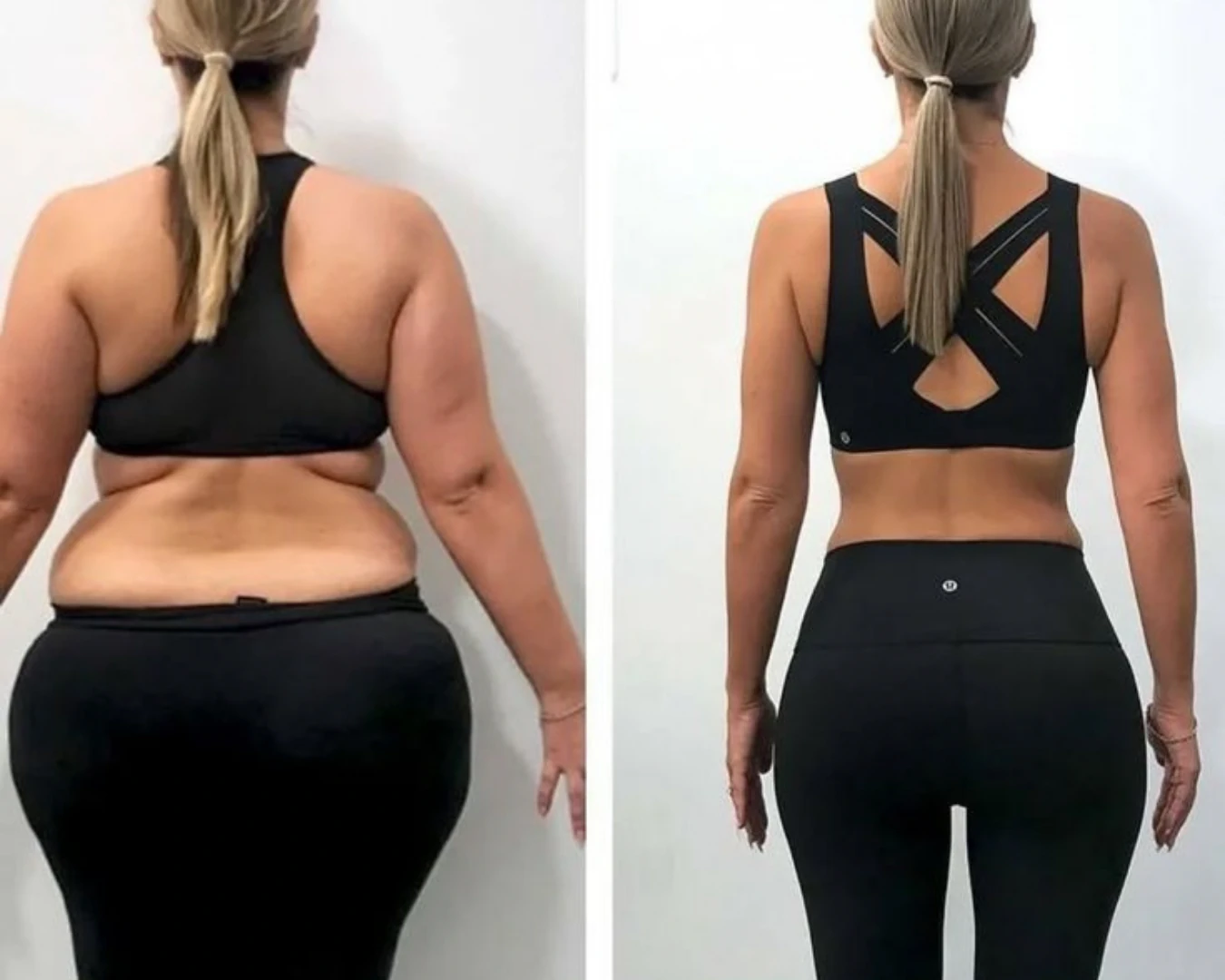 Before & After