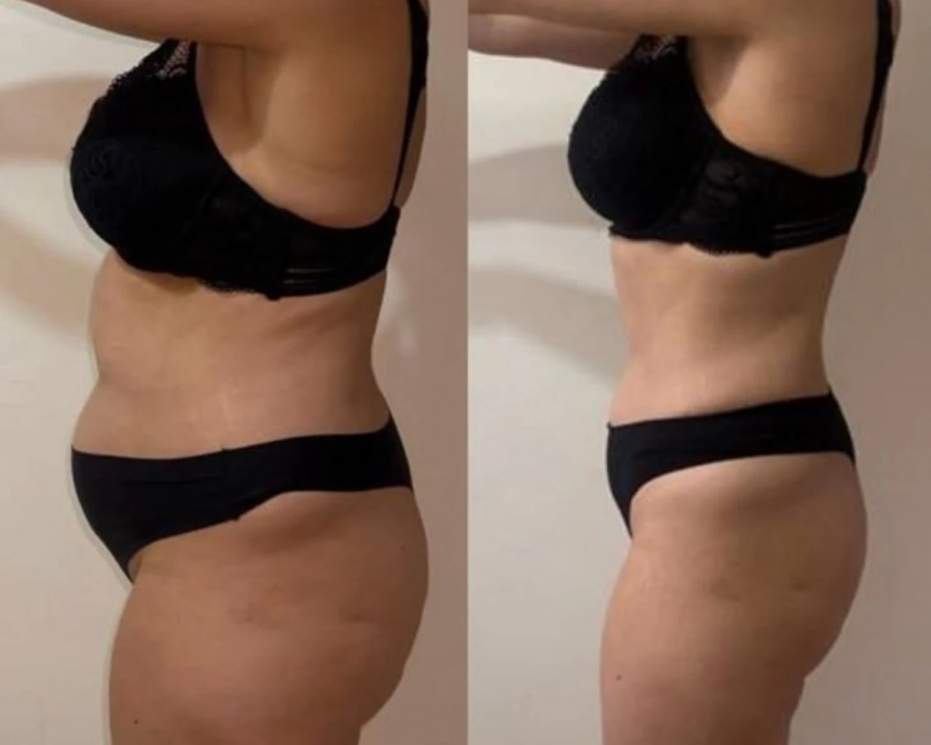 Before & After