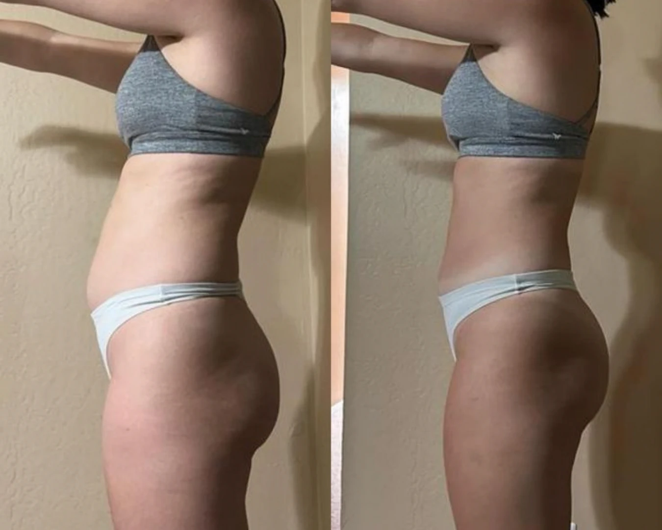 Before & After