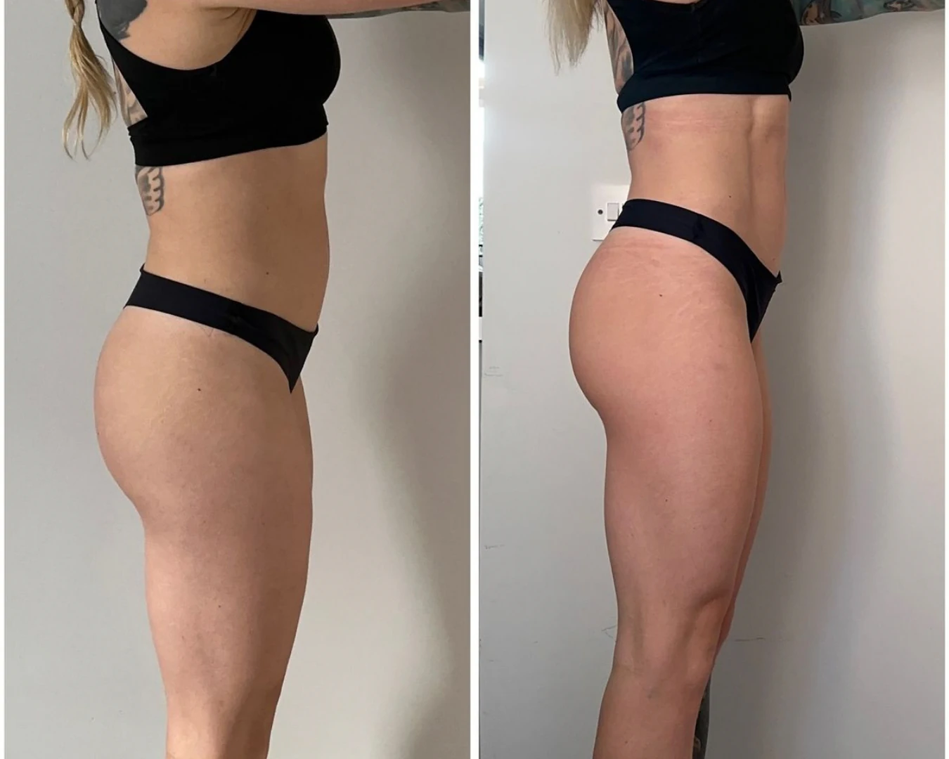 Before & After